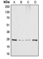 Polyclonal Rabbit anti-Human DDIT3 / CHOP Antibody (Internal, IHC, IF, WB)