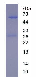 Mouse IgG1 Protein (Native His, N-Terminal)