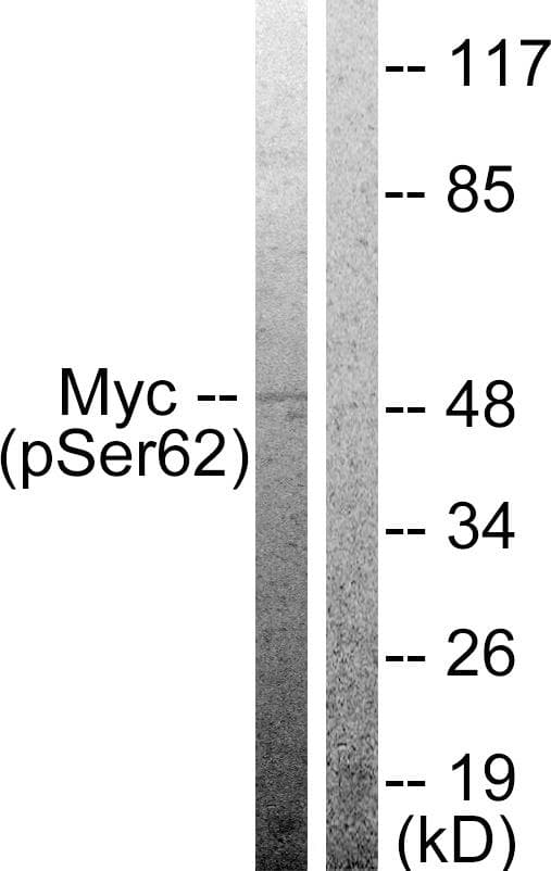 MYC / c-Myc Antibody (phospho-Ser62)