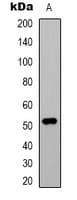 Beta Tubulin Antibody