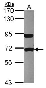 Polyclonal Rabbit anti-Human UTP6 Antibody (aa213-597, IHC, WB)
