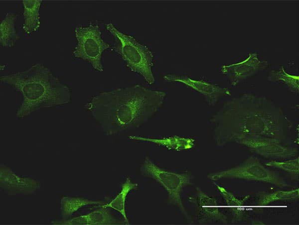 TXK / RLK Antibody (clone 2D8)