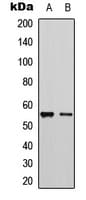 CYP2D6 Antibody (Internal)