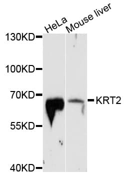 KRT2 / CK2 / Cytokeratin 2 Antibody