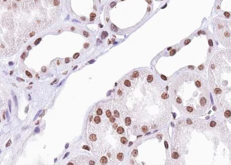 ATF2 Antibody (phospho-Ser112,pSer94)
