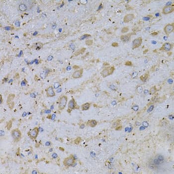 GAD65 Antibody