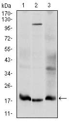 IHC-plus™ UBE2I / UBC9 Antibody (clone 1B10)