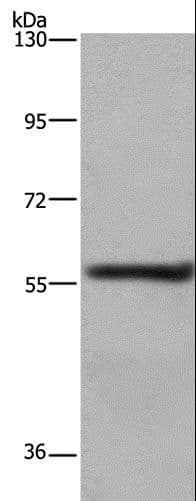 FRK Antibody
