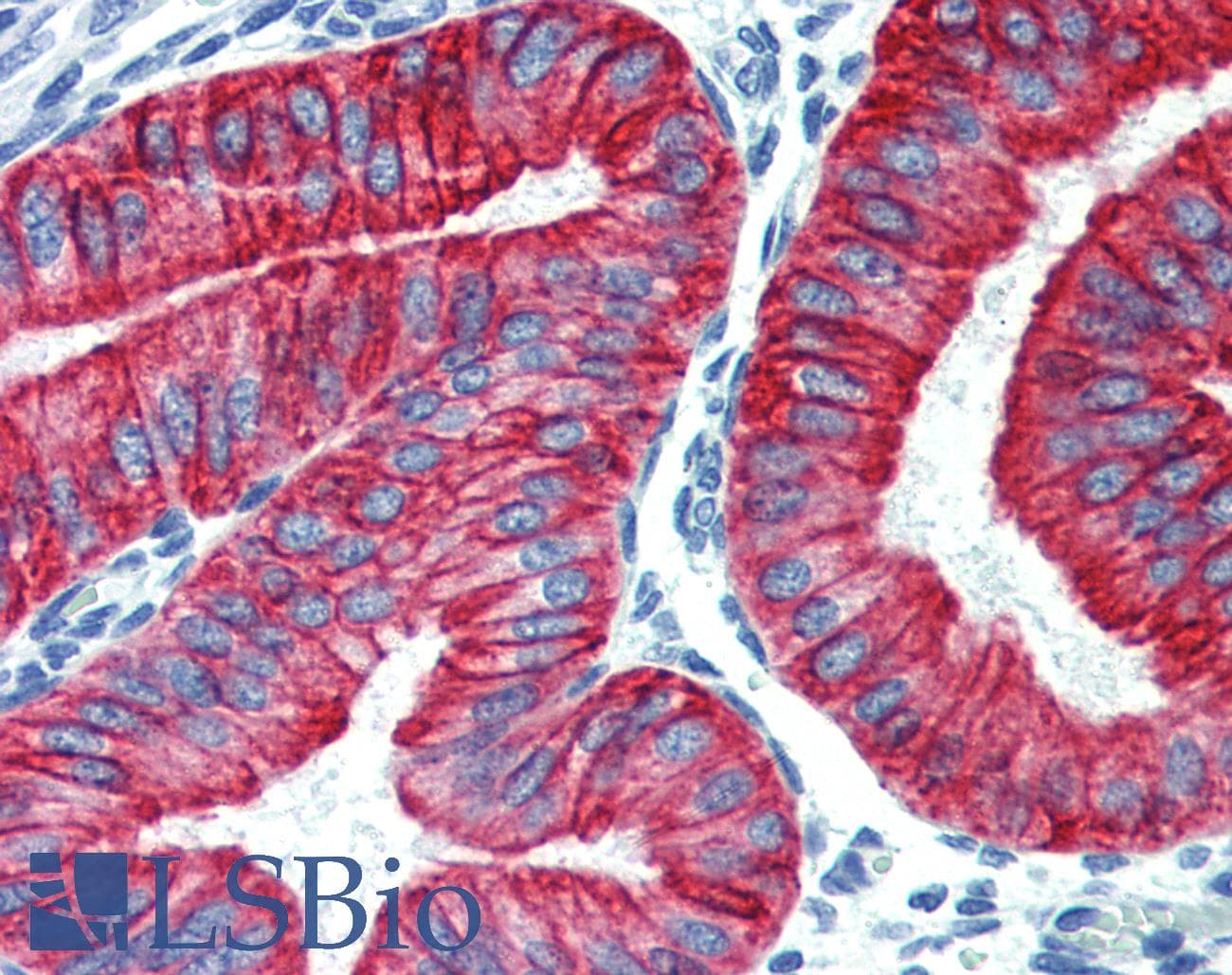 PathPlus™ Polyclonal Rabbit anti-Human KRT19 / CK19 / Cytokeratin 19 Antibody (clone E16-L, C-Terminus, IHC)