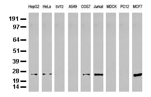 MGMT Antibody (clone UMAB52, Carrier-free)