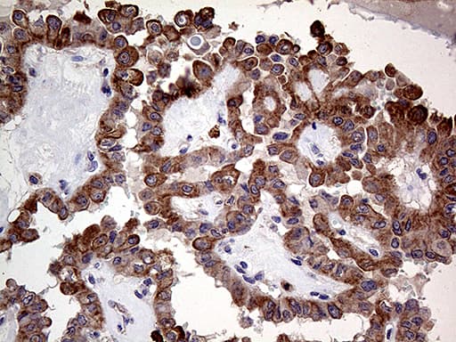 Monoclonal Mouse anti-Human ARHGEF18 Antibody (clone OTI6D10, aa118-215, IHC, WB)