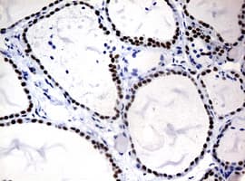 NBN / Nibrin Antibody (clone OTI3A9)