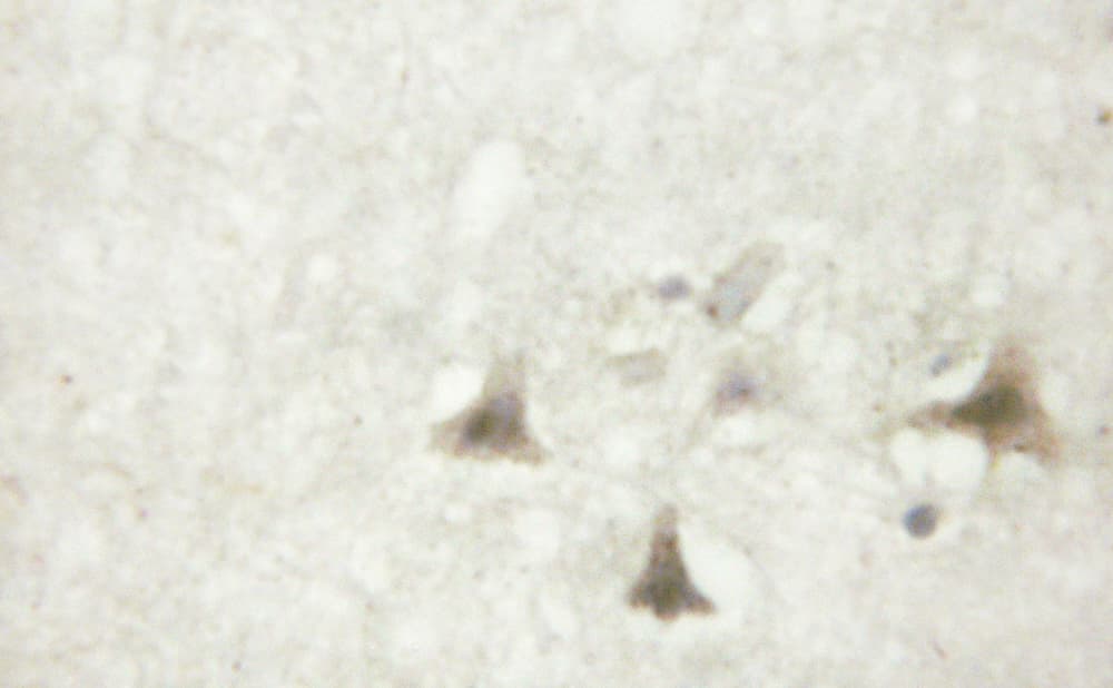CTNNB1 / Beta Catenin Antibody (phospho-Tyr489)