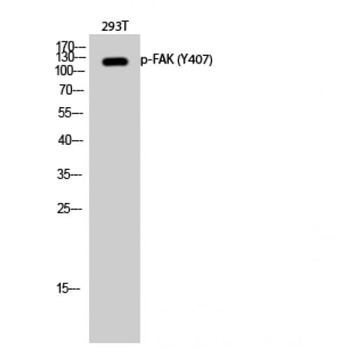 FAK / Focal Adhesion Kinase Antibody (350-430 aa)