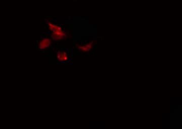 CDK5RAP3 Antibody