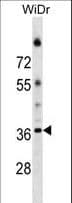 Polyclonal Rabbit anti-Human ALG5 Antibody (aa74-100, WB)