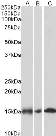 IHC-plus™ NDUFA7 Antibody (aa39-52)