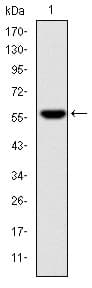 FGG / Fibrinogen Gamma Antibody (clone 4H9)