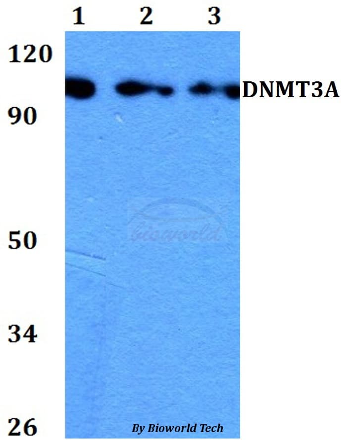 Polyclonal Rabbit anti-Human DNMT3A Antibody (WB)