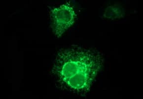 Placental Lactogen Antibody (clone OTI2A2)