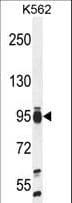 IHC-plus™ Polyclonal Rabbit anti-Human TAF4B Antibody (aa647-675, IHC, WB)