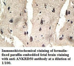 ANKRD50 Antibody (aa524-743)