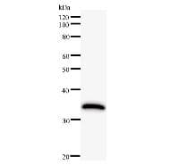 HIVEP1 / MBP-1 Antibody (clone 2417C2 a)