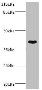 SETD7 / SET7 Antibody