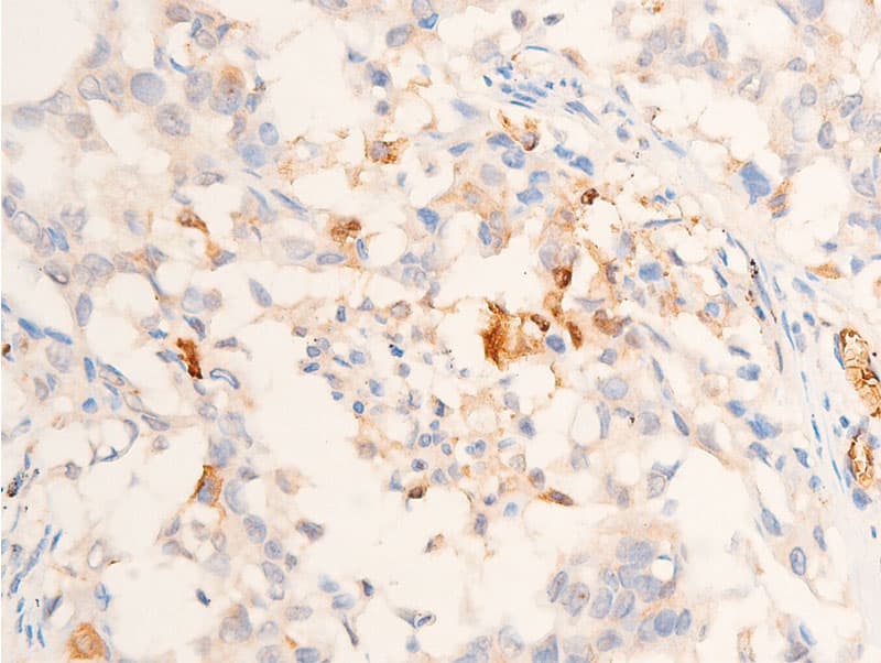 TGFB1 / TGF Beta 1 Antibody