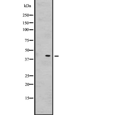 GnRH-II-R / GNRHR2 Antibody