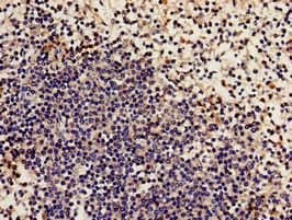 Polyclonal Rabbit anti-Human NCF2 / NOXA2 / p67phox Antibody (IHC, IF, WB)