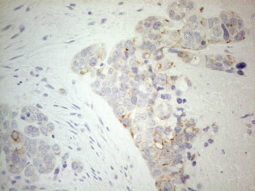 ERBB3 / HER3 Antibody (aa983-1342, clone OTI3C1)