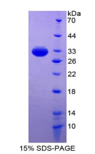 Human NFKBIB / IKB Beta / IKBB Protein (Recombinant His-T7)