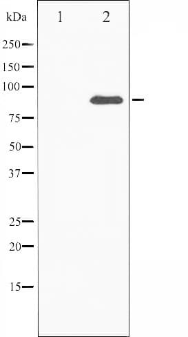 CTTN / Cortactin Antibody