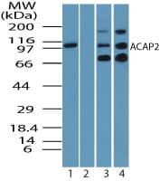 Polyclonal Rabbit anti-Human ACAP2 / Centaurin Beta 2 Antibody (aa350-400, IHC, WB)