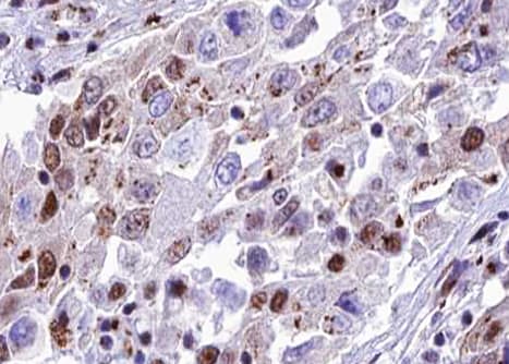 RELA / NFKB p65 Antibody (phospho-Ser468)