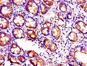 ACO1 / Aconitase Antibody