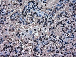 MAPK1 / ERK2 Antibody (clone OTI6E5)