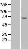 Human CHEK2 / CHK2 Protein (Over-Expression Lysate Myc-DDK (Flag))