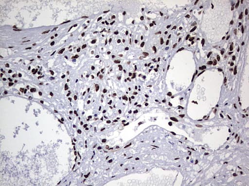 HNRNPL / hnRNP L Antibody (aa270-502, clone OTI9F11)
