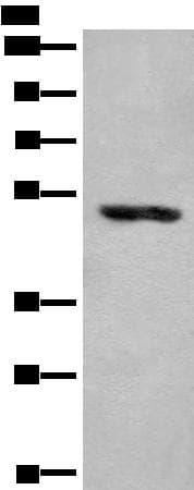 KLHDC2 / LCP Antibody