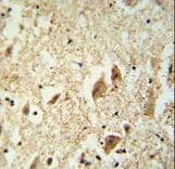 KATNAL1 Antibody (aa137-166)