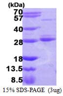 Human RAB17 Protein (Recombinant His)