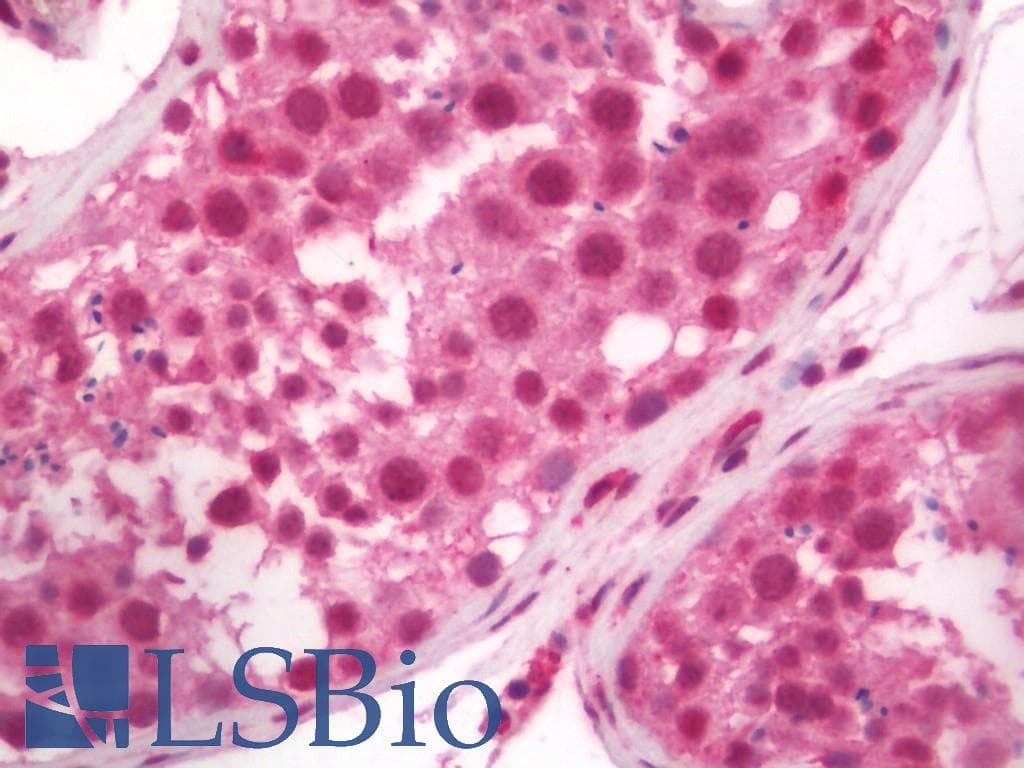IHC-plus™ Polyclonal Rabbit anti-Human SREBF2 / SREBP2 Antibody (IHC, IF, WB)