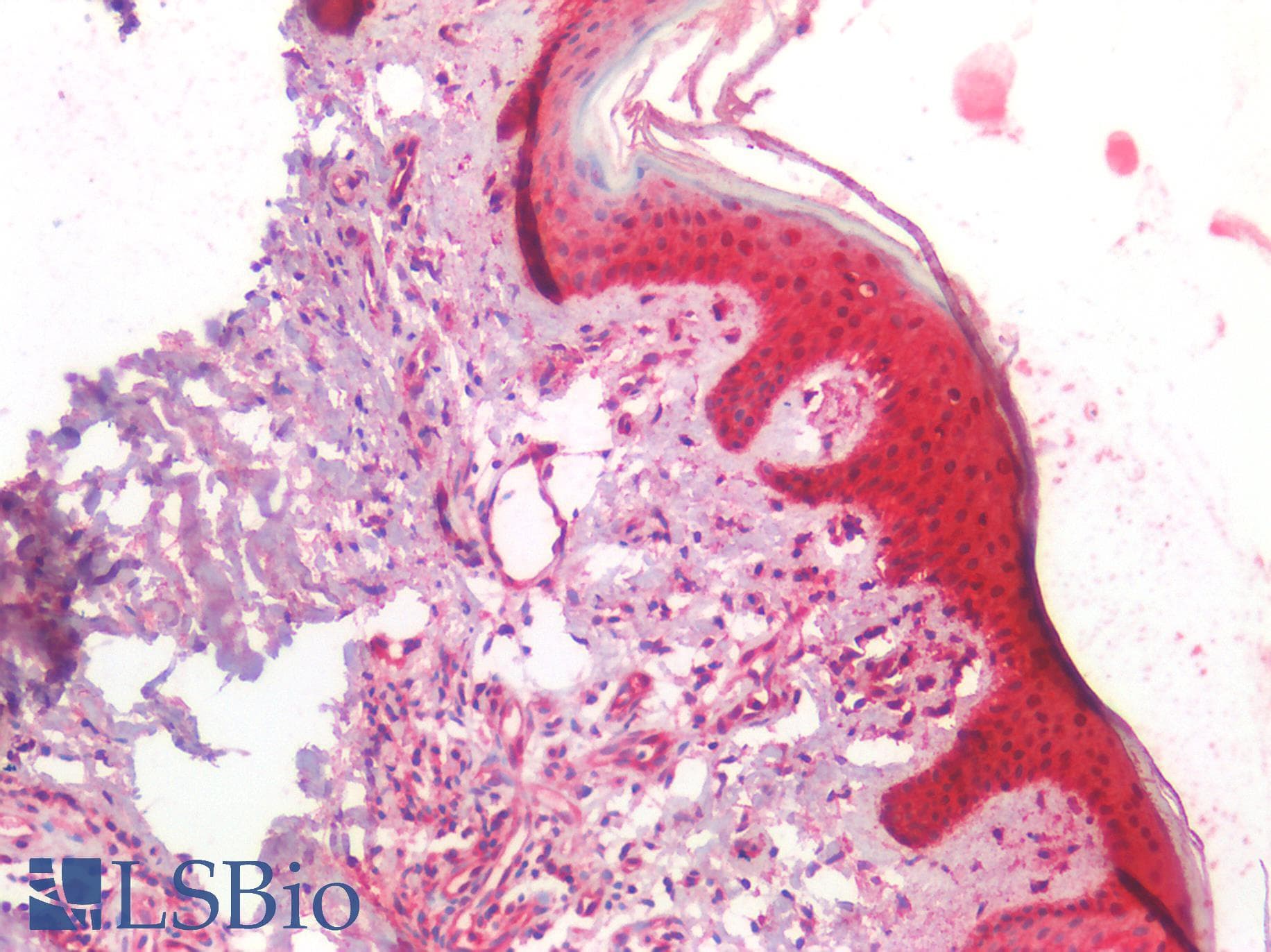 IHC-plus™ NDRG1 Antibody (clone AT11G4)