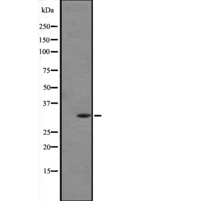 Polyclonal Rabbit anti-Human FGF5 Antibody (WB)