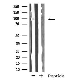 PPP1R15A / GADD34 Antibody