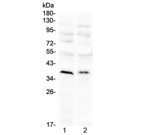 Polyclonal Rabbit anti-Mouse ATOH1 / MATH-1 Antibody (WB)