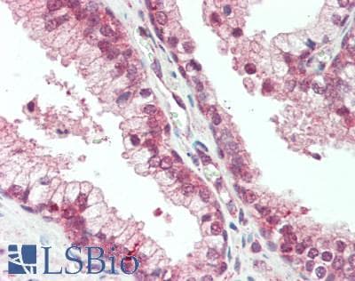 IHC-plus™ Polyclonal Rabbit anti-Human PLXNB1 / Plexin-B1 Antibody (IHC)
