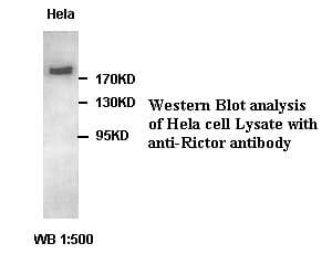 IHC-plus™ Polyclonal Rabbit anti-Human RICTOR Antibody (IHC, WB)